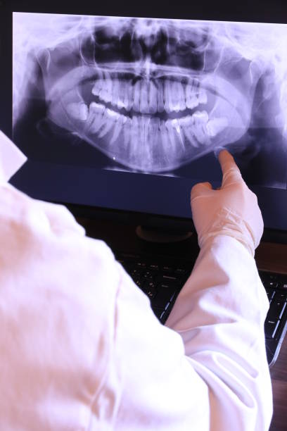 Best Emergency Root Canal Treatment in Lucerne Valley, CA