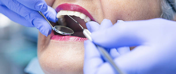 Best Mobile Emergency Dentist in Lucerne Valley, CA